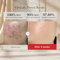 Before and after skin treatment results showing clinical improvements.