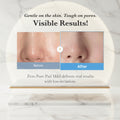 Before and after comparison of skin with pores, featuring text about product effectiveness and suitability for various skin types.