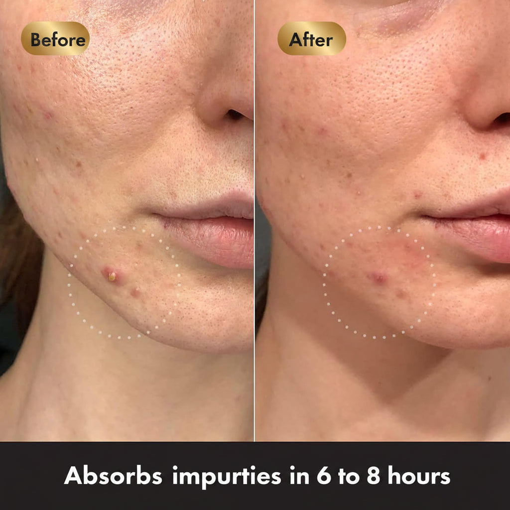 Before and after comparison of a person's face with acne, showing skin absorption of impurities.