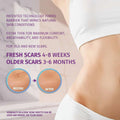 Promotional graphic for Vibe Beauti silicone scar sheets, showing a close-up of a woman's midsection with text explaining use for fresh and older scars, plus before-and-after circular images on a pale pink background.