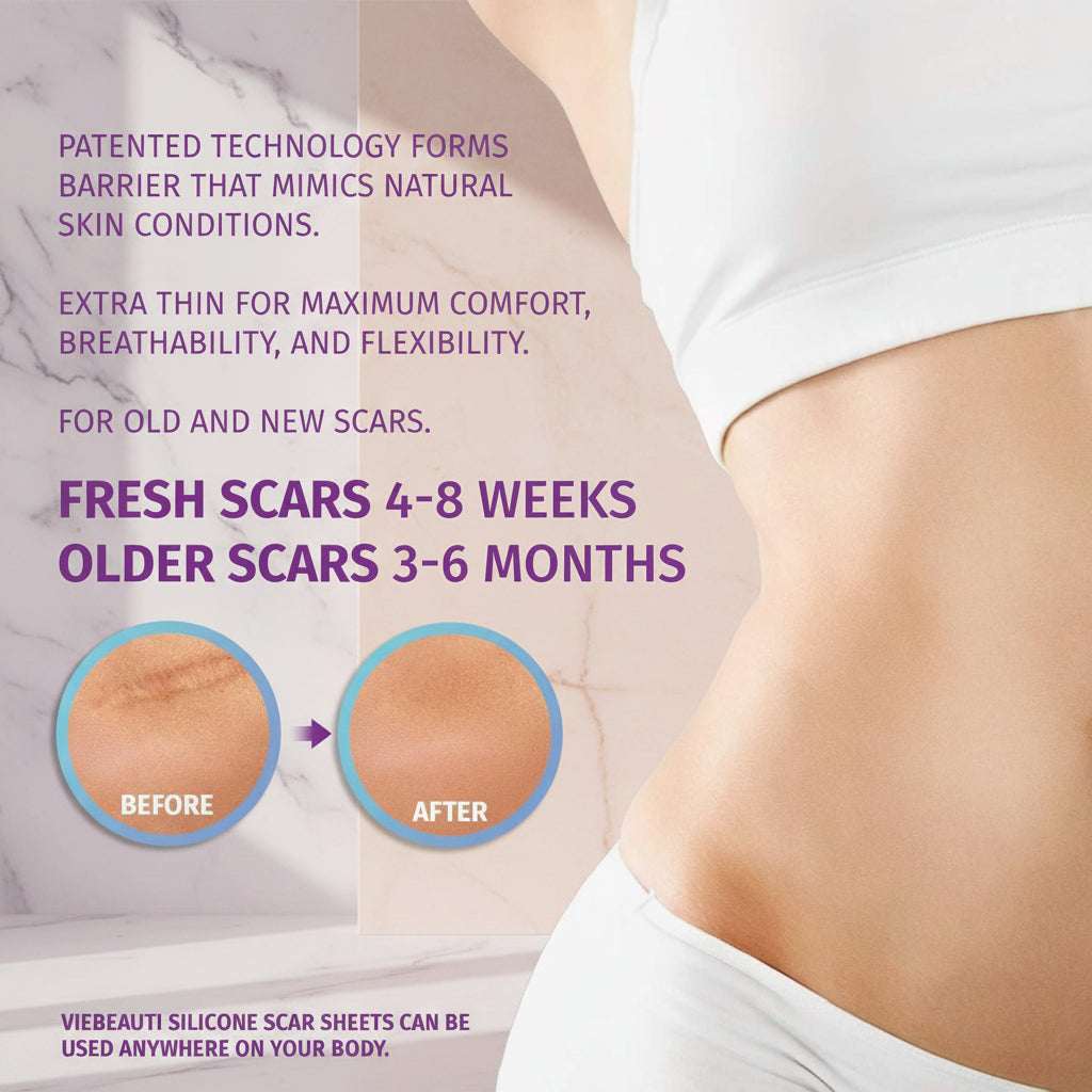 Promotional graphic for Vibe Beauti silicone scar sheets, showing a close-up of a woman's midsection with text explaining use for fresh and older scars, plus before-and-after circular images on a pale pink background.