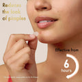 Person applying a patch to their face with text indicating it reduces the look of pimples and is effective from 6 hours.