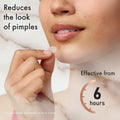 Person applying a patch to their face with text indicating it reduces the look of pimples and is effective from 6 hours.