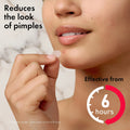 Person applying a patch to their face with text indicating it reduces the look of pimples and is effective from 6 hours.