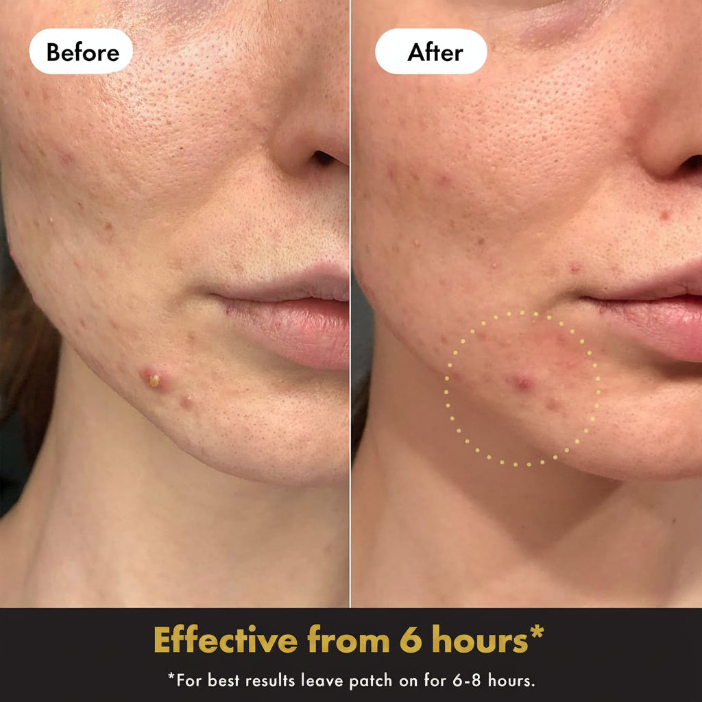 Before and after comparison of a skin treatment patch on a person's face.
